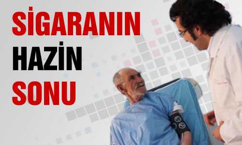 63 YIL SİGARA İÇTİ VE...