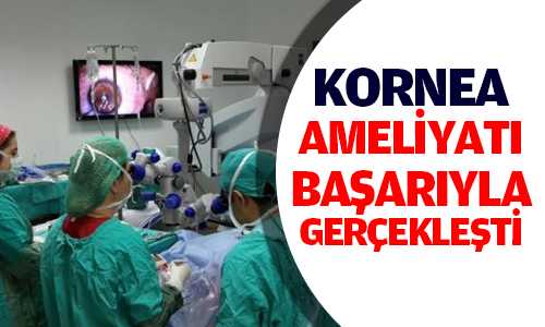Araştırma Hastanesinde Kornea Ameliyatı Başarıyşa Gerçekleştirildi