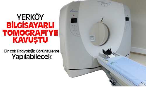 Yerköy’de Bilgisayarlı Tomografi Hizmeti Verilmeye Başladı